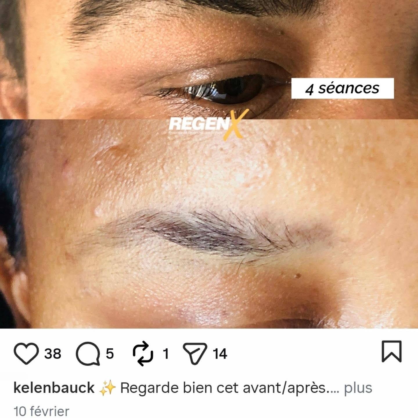 Comparaison de sourcils sur le visuel fourni, avec mention de quatre séances