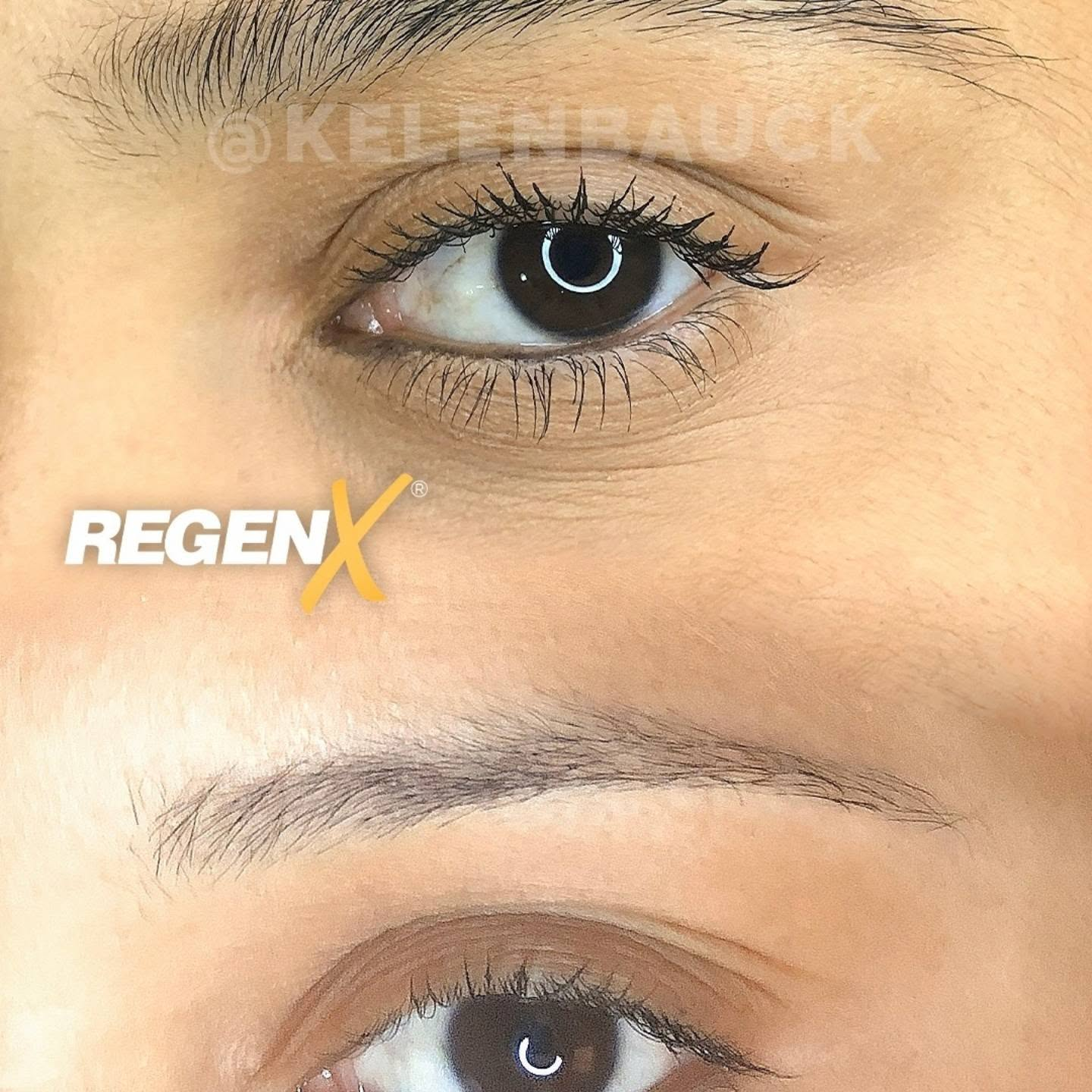 Deux vues de sourcils sur un visuel REGEN X fourni